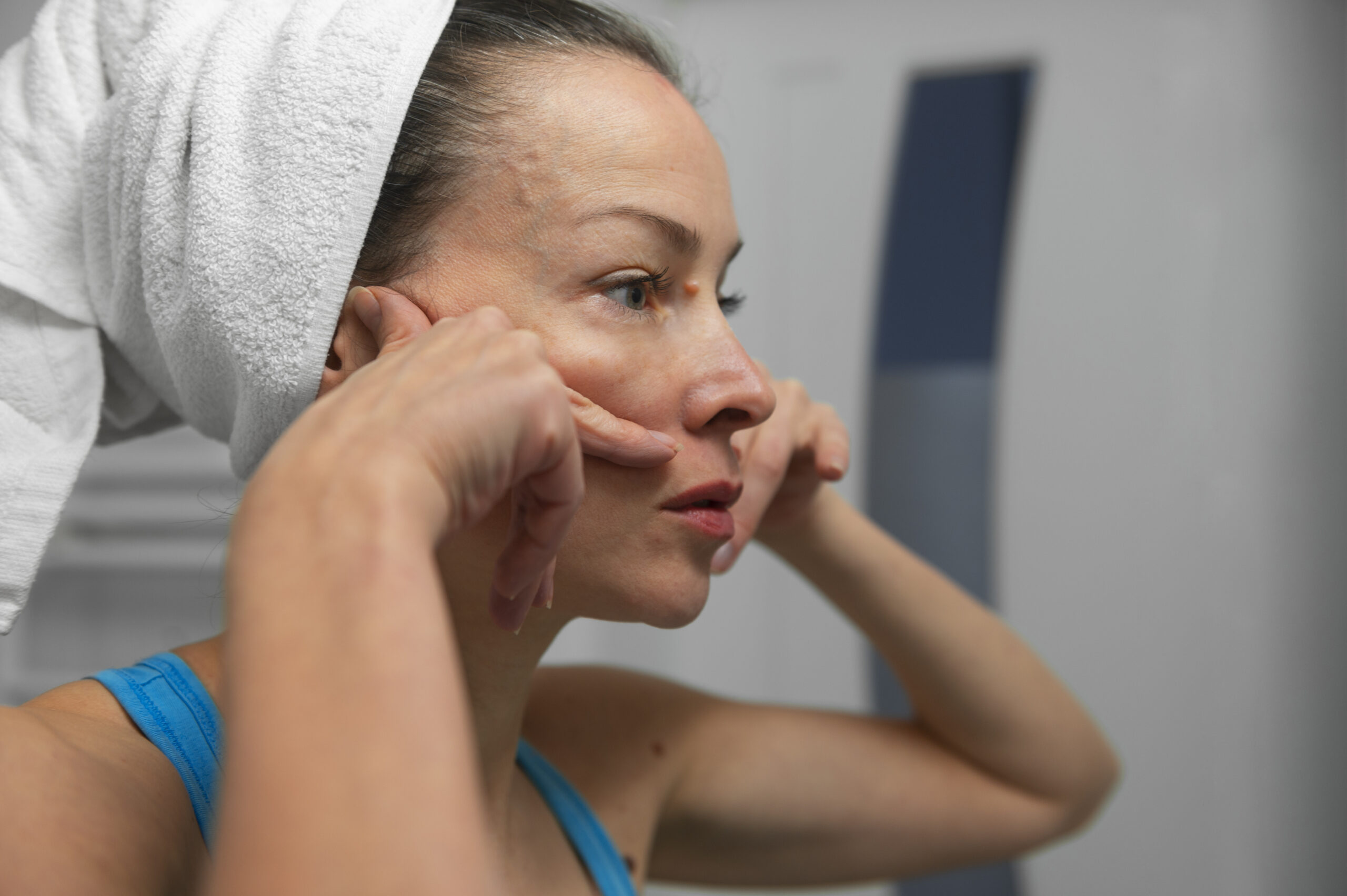 What Can Cause Acne Breakouts in Adults