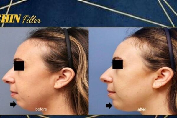 imgi_57_rs=w_719,h_404