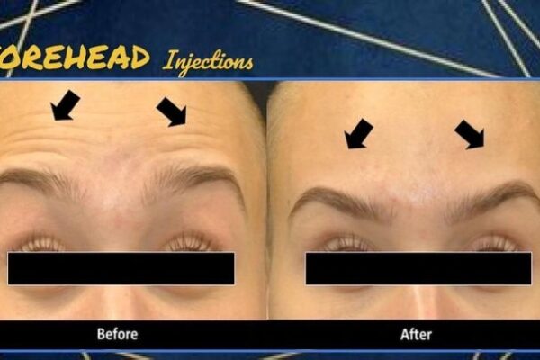 imgi_59_rs=w_719,h_404