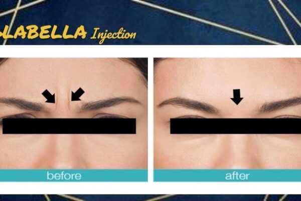 imgi_61_rs=w_719,h_404