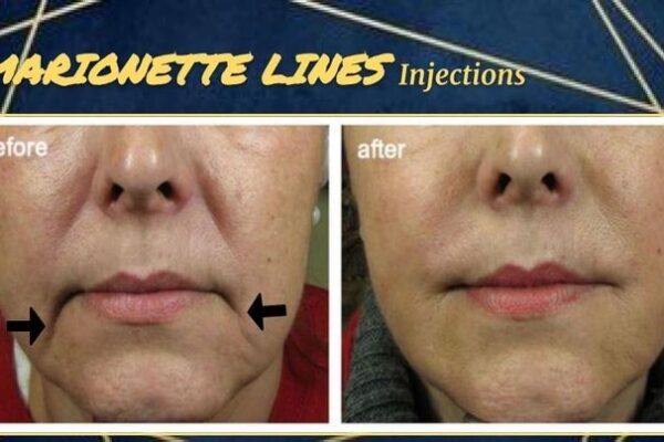 imgi_63_rs=w_719,h_404