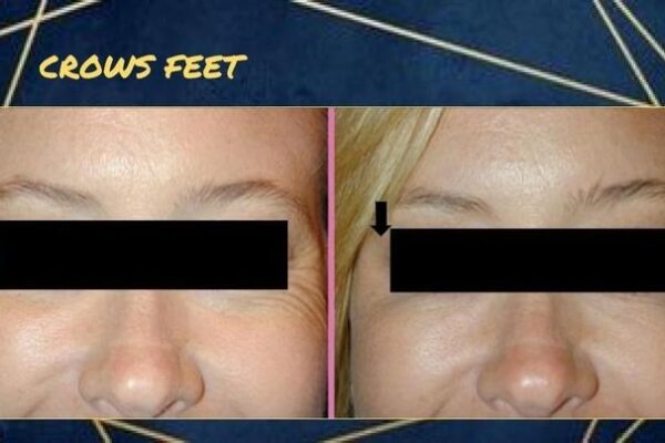 imgi_65_rs=w_719,h_404