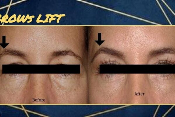 imgi_67_rs=w_719,h_404