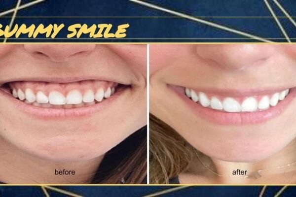 imgi_69_rs=w_719,h_404