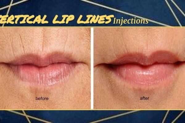 imgi_71_rs=w_719,h_404