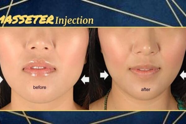 imgi_73_rs=w_719,h_404